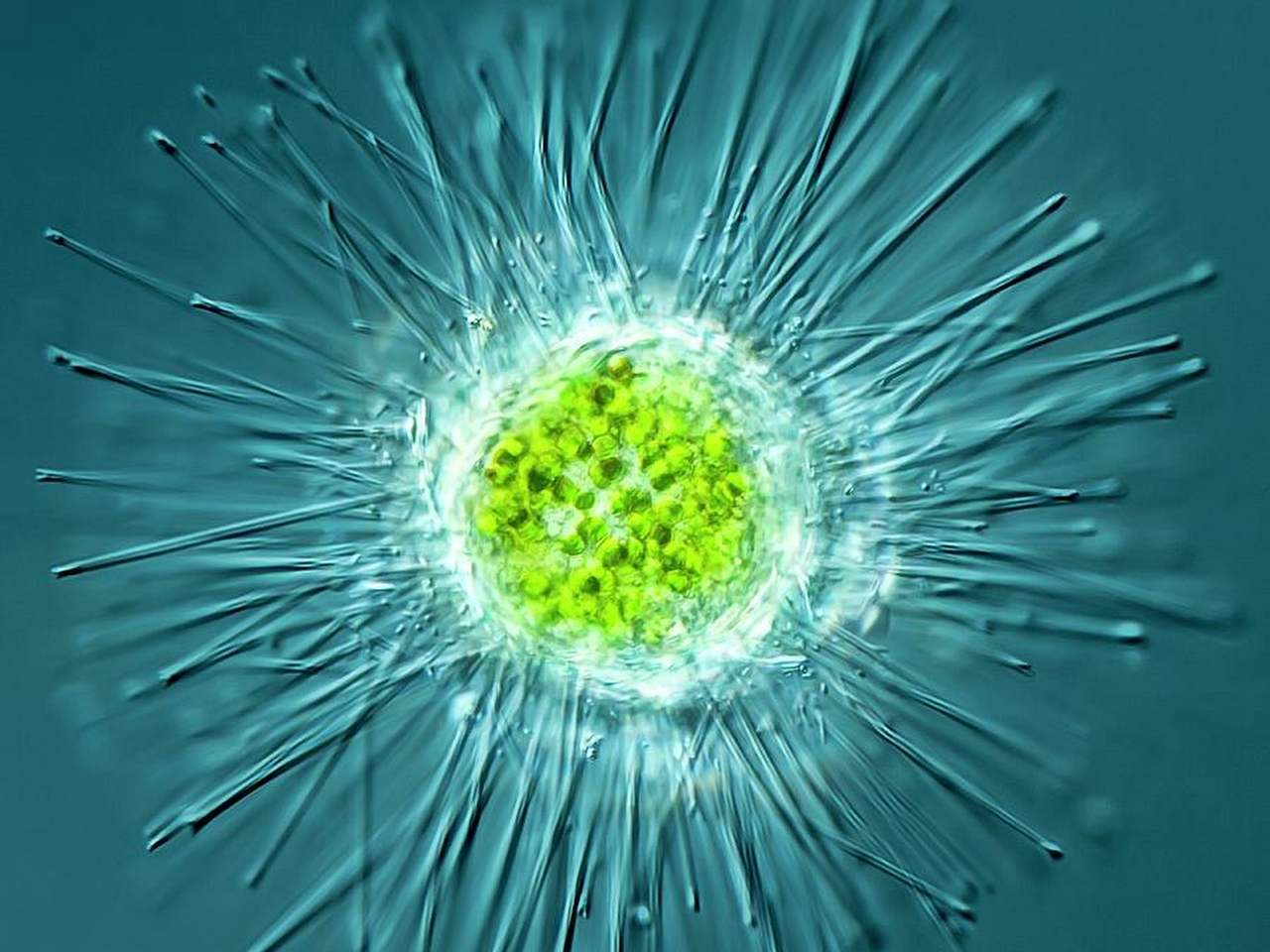 Actinosphaerium Resimleri Actinosphaerium Resimleri