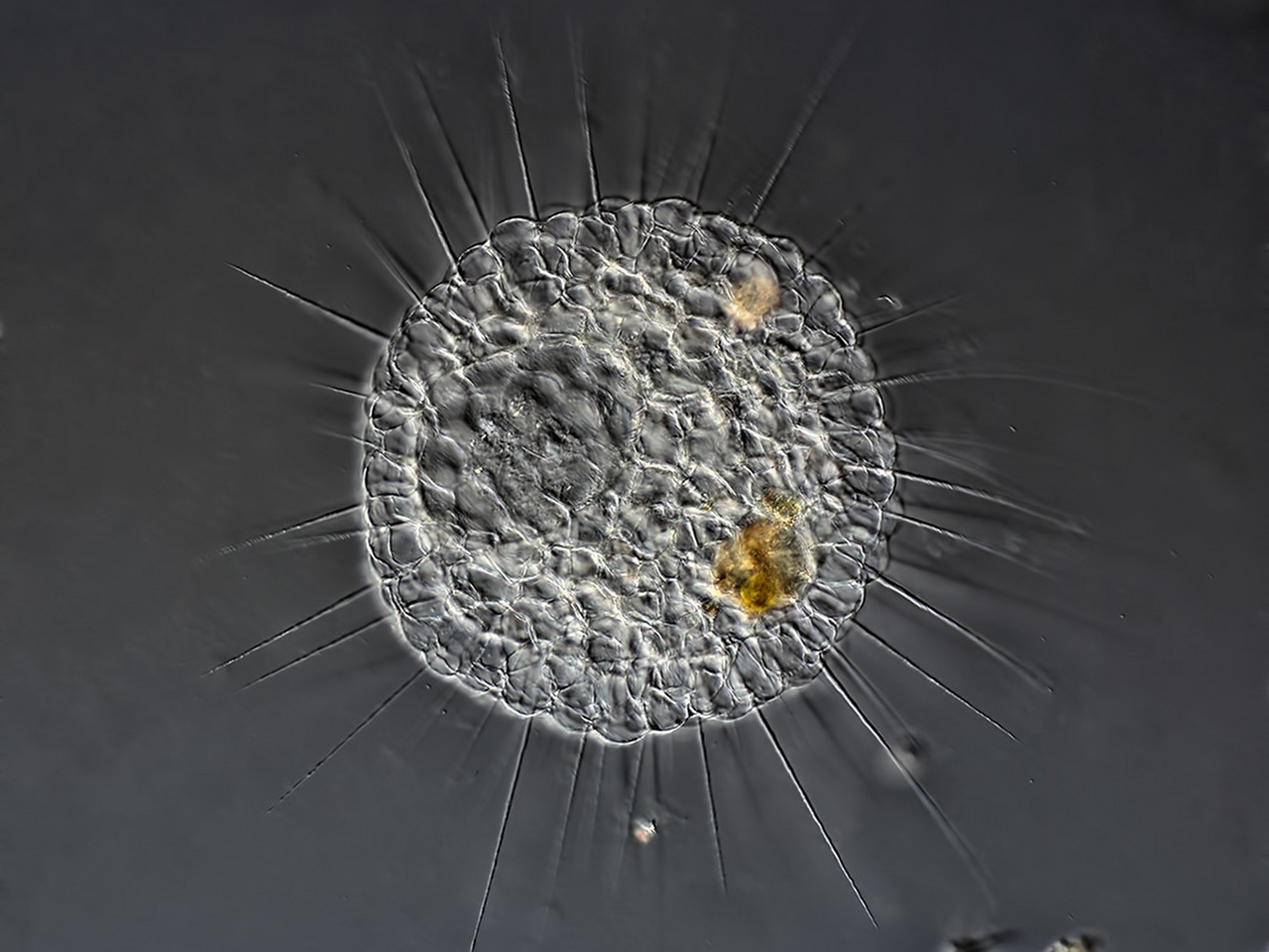 Actinosphaerium Resim Actinosphaerium Resim