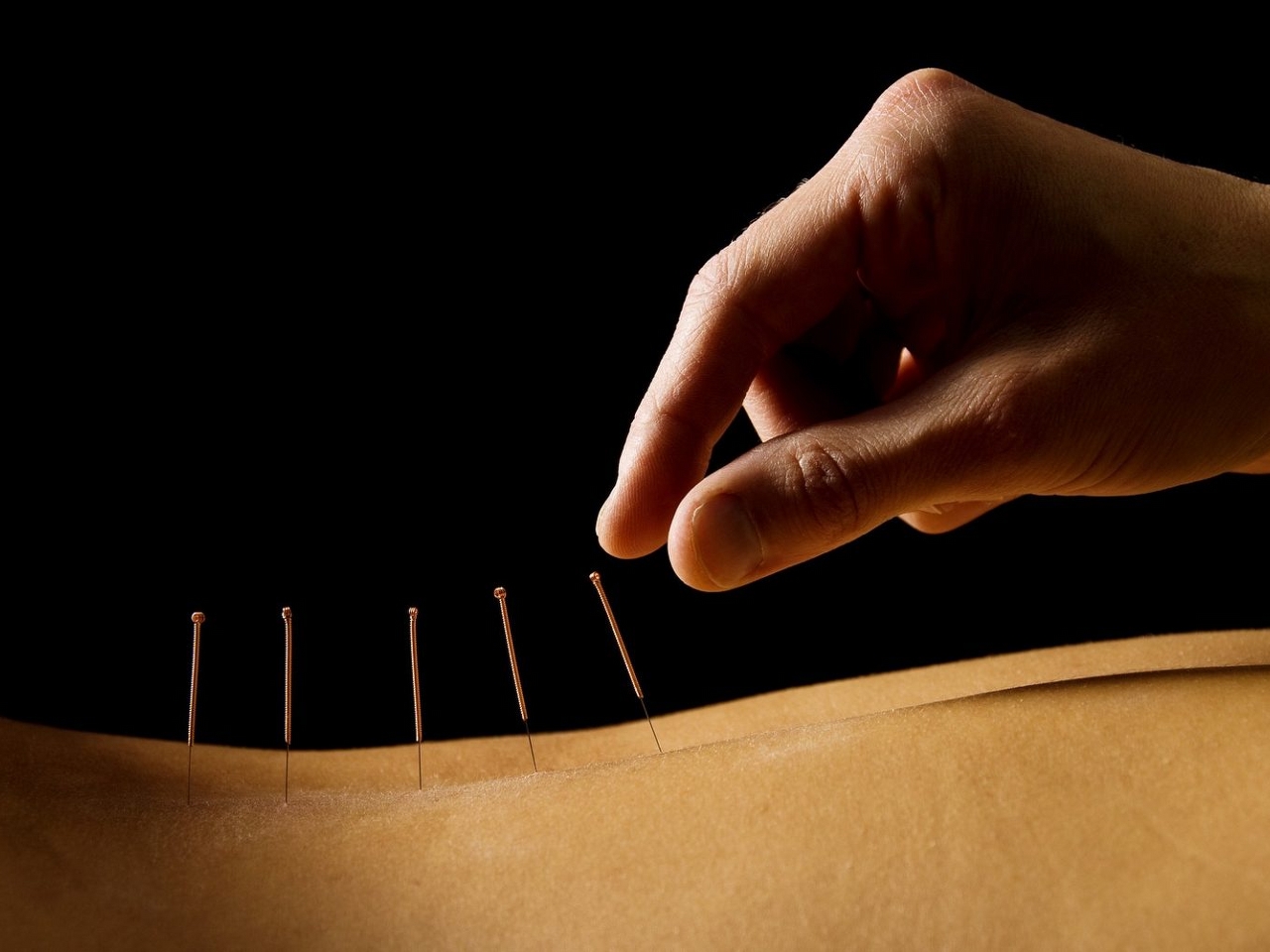 Akupunktur Resim